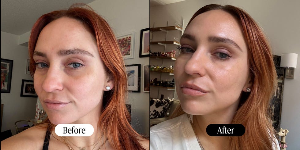ulike led mask review